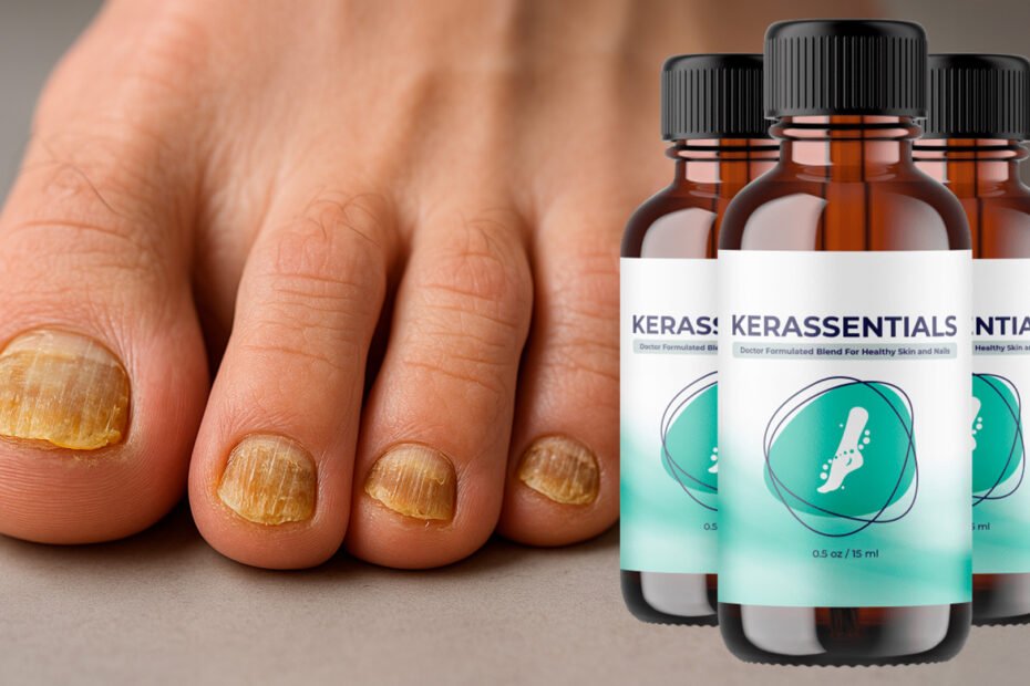 Kerassentials review - antifungal oil bottles